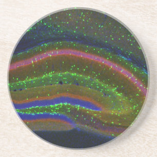 Posavasos Interneuron 6