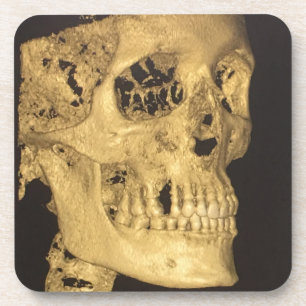 Posavasos Scary Skull