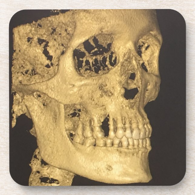 Posavasos Scary Skull (Frente)
