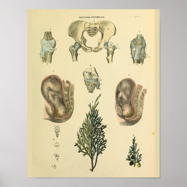 Posición fetal Impresión del arte de la cosecha de (Frente)