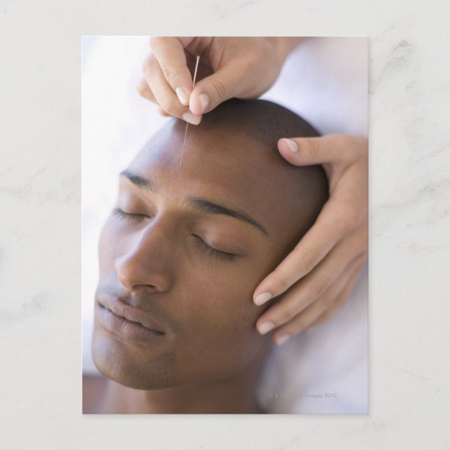 Postal Acupuntura. Acupuncturist que inserta una aguja (Anverso)
