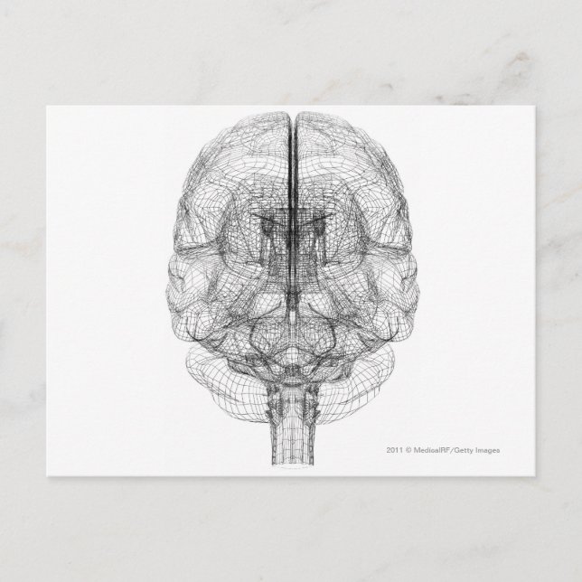 Postal Alambre del cerebro (Anverso)