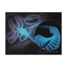 Ampliación de una cadena de ADN en un cromosoma