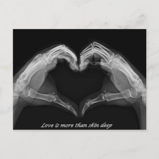 Postal Arte de rayos X