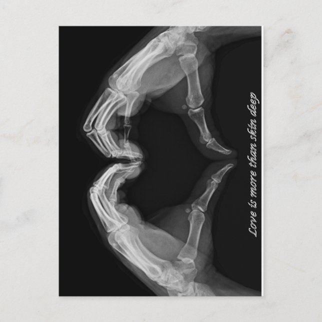 Postal Arte de rayos X (Anverso)