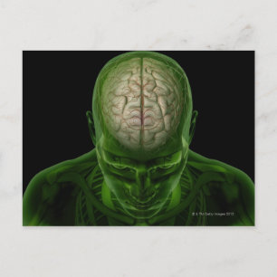 Postal Arterias cerebrales