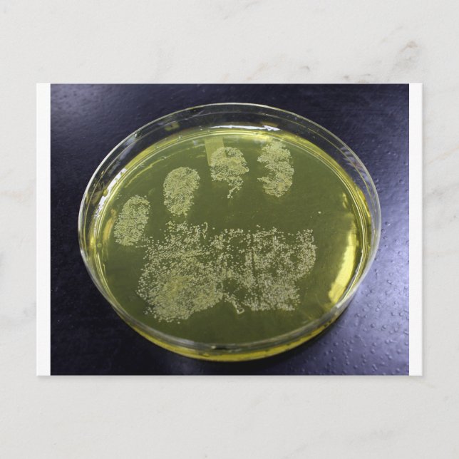 Postal Bacteria Hand Petri Dish (Anverso)