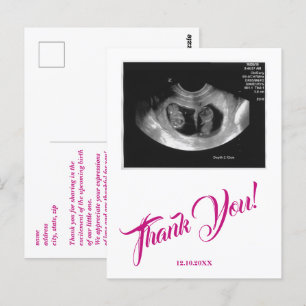 Postal Baño para bebé Ecografía Niña Rosa Gracias.