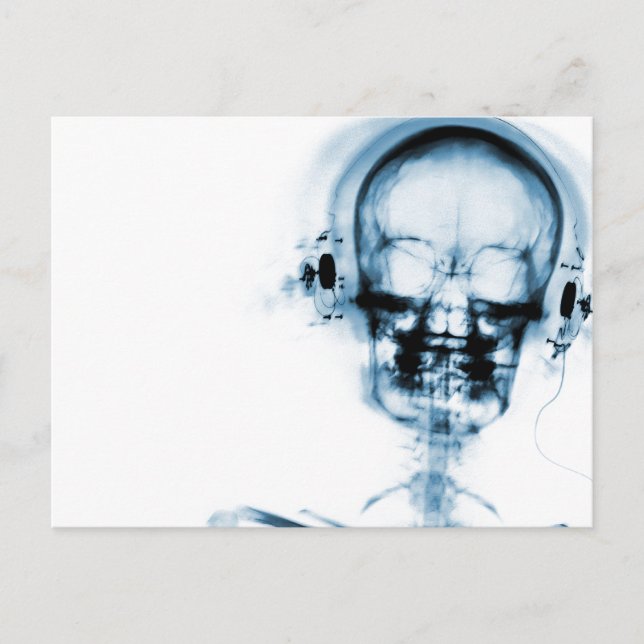 Postal Blue X-Ray Vision Music Skeleton Skull (Anverso)