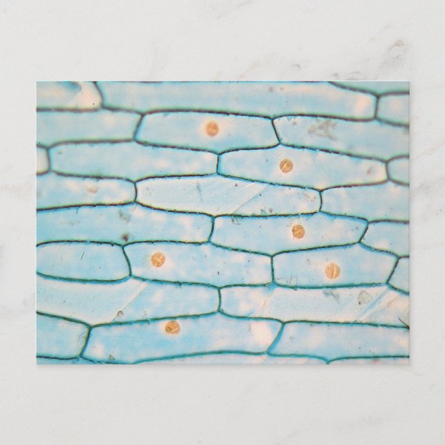 Postal Cebolla en el microscopio (Anverso)