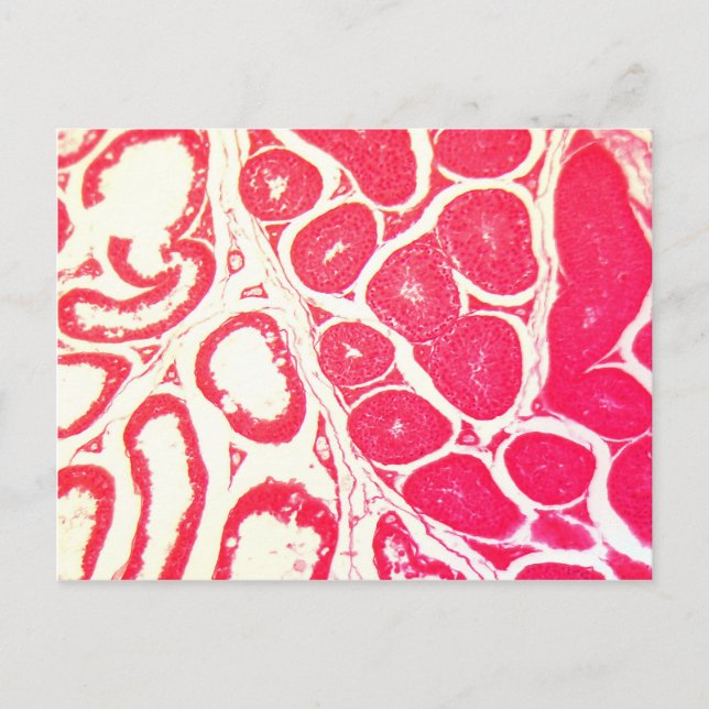 Postal Celdas de testículo bajo el microscopio (Anverso)