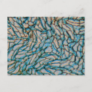 Postal Células de pimienta Campana bajo el microscopio