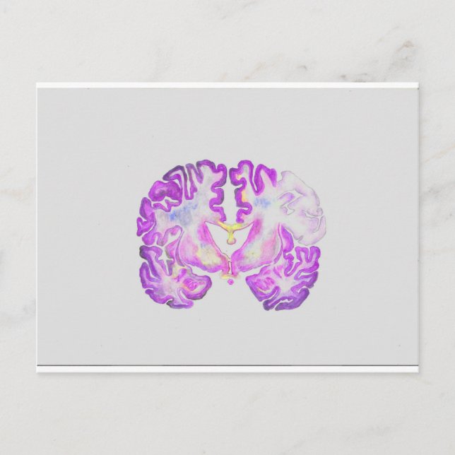 Postal Cerebro (Anverso)