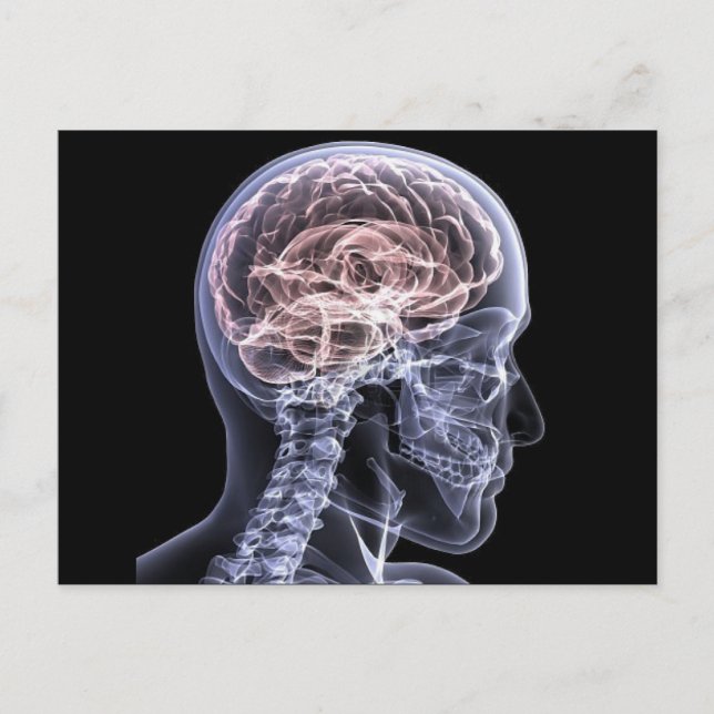 Postal Cerebro de rayos X (Anverso)