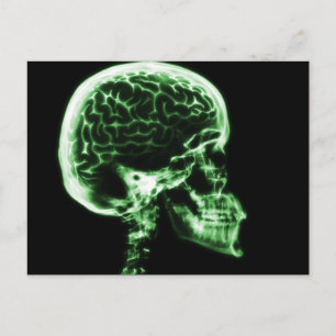 POSTAL CEREBRO DE RAYOS X - VERDE