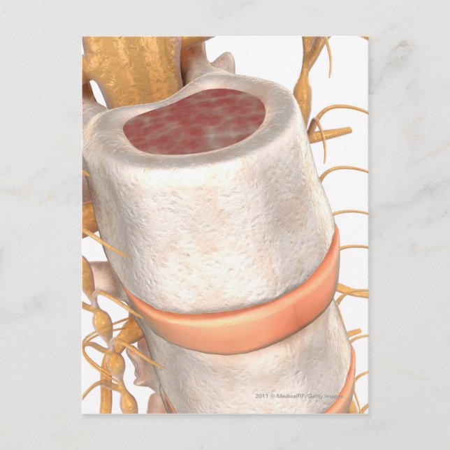 Postal Cierre de un disco invertebral en la columna verte (Anverso)