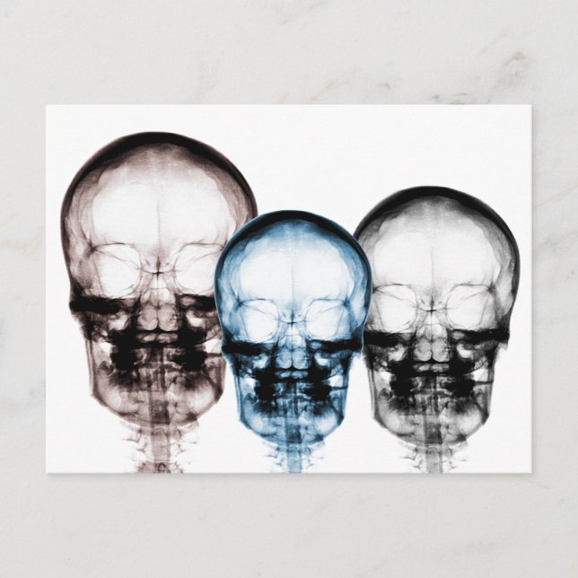 Postal Colores mixtos Rayos X Visión Skeleton Skulls (Anverso)