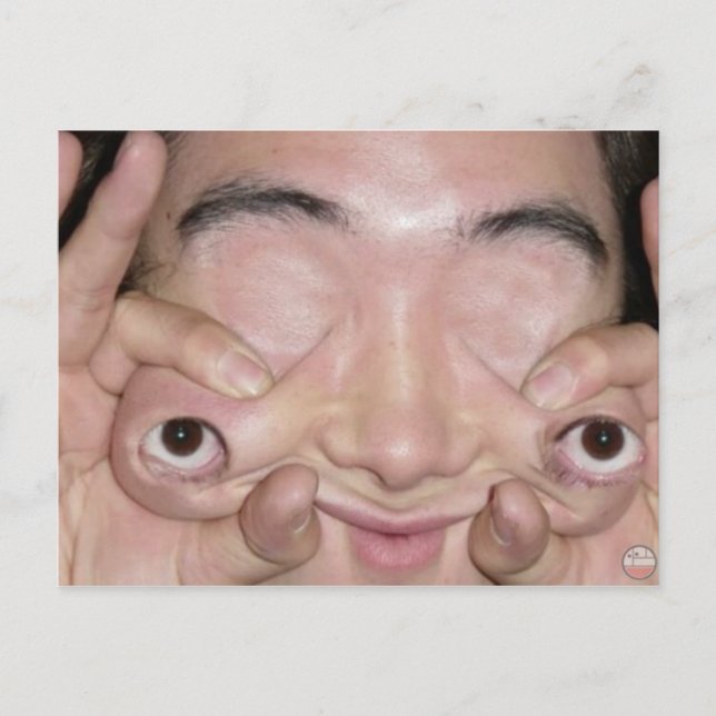 Postal Cosas raras (Anverso)