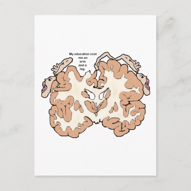 Postal Costó un brazo y un homúnculo de pierna (Anverso)