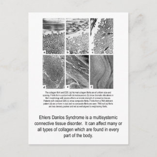 Postal culpable de la conciencia del EDS del
