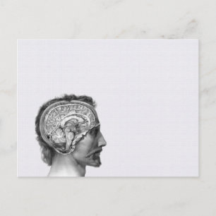 Postal de Ilustracion médico de época