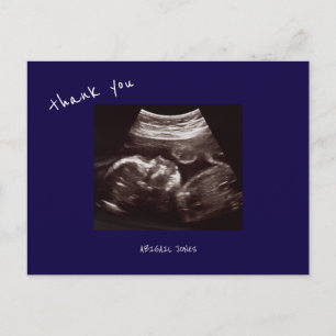 Postal Ecosonograma de Baby Shower Agradable Azul Marino