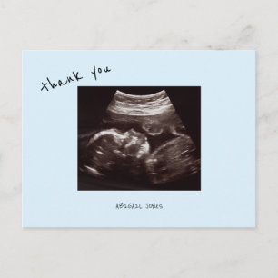 Postal Ecosonograma de Baby Shower Azul Claro Lindo Graci