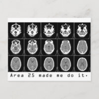 El área 25 me hizo hacerlo.