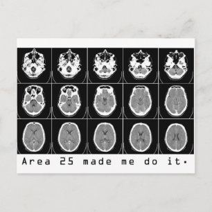 Postal El área 25 me hizo hacerlo.