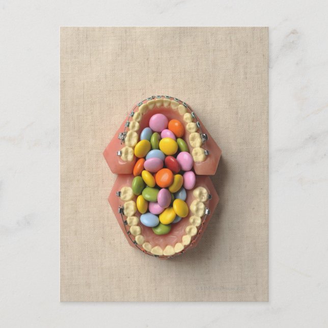 Postal El chocolate servido en el modelo dental (Anverso)