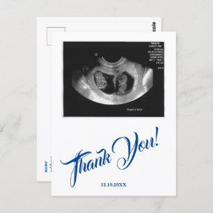 Postal Gracias A Baby Shower Ultrasound Boy Blue.