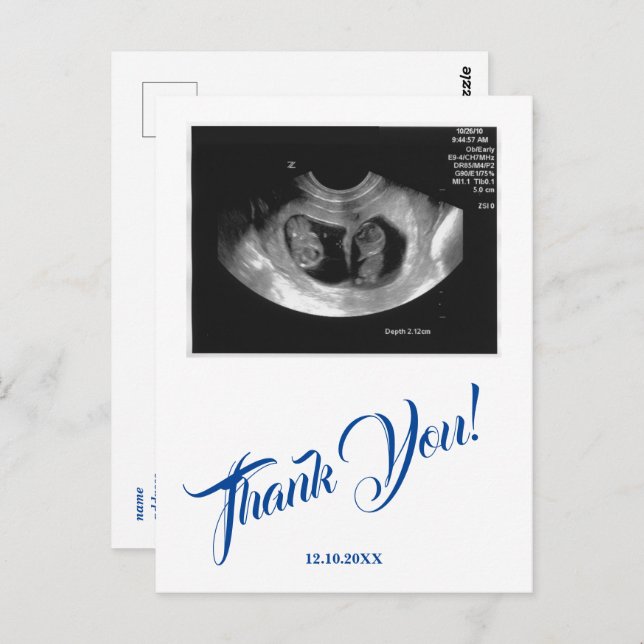 Postal Gracias A Baby Shower Ultrasound Boy Blue. (Anverso / Reverso)