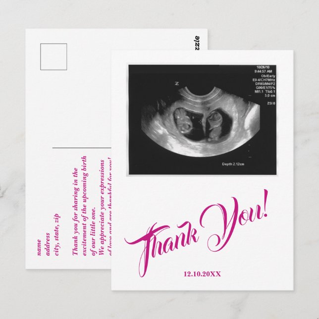 Postal Gracias Rosa, Chica De Ultrasonido De Baby Shower. (Anverso / Reverso)