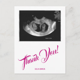 Postal Gracias Rosa, Chica De Ultrasonido De Baby Shower.