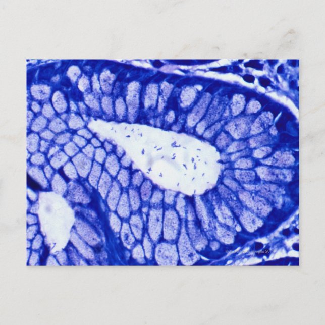 Postal Helicobacter Pylori (Anverso)