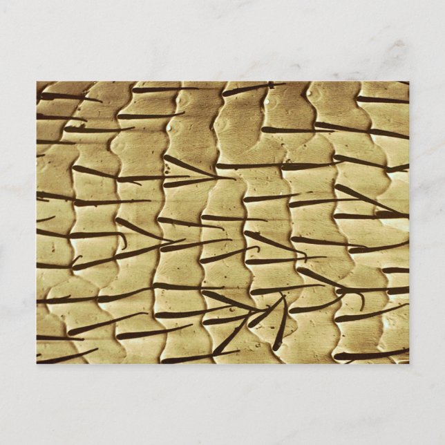 Postal Hormiga - pierna delantera (Anverso)