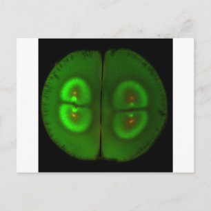 Postal Huevo de rana fertilizada