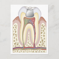 Ilustracion del relleno dental