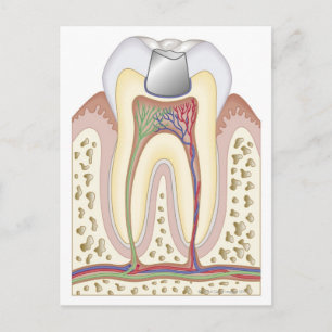 Postal Ilustracion del relleno dental
