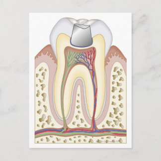 Postal Ilustracion del relleno dental