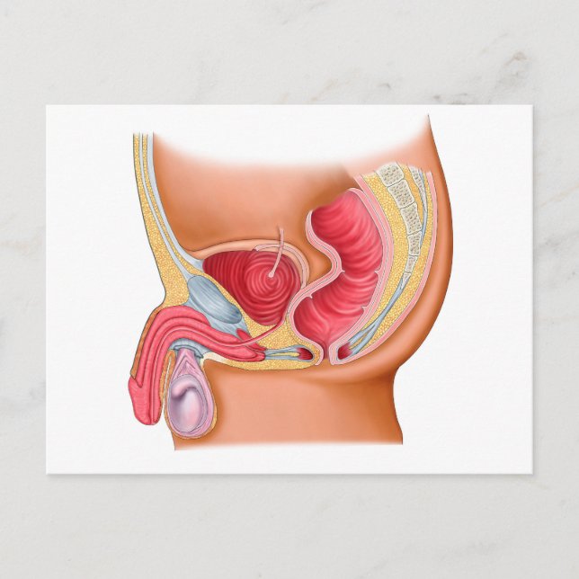 Postal Ilustracion Médico De Una Fistula Rectouretral (Anverso)