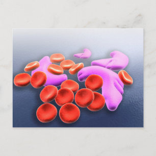 Postal Imagen conceptual de anemia falciforme