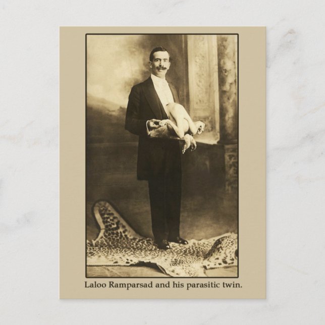 Postal Laloo, el feliz hindoo con un gemelo parasitario (Anverso)