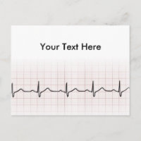 latido del corazón de EKG en papel gráfico, pulso 