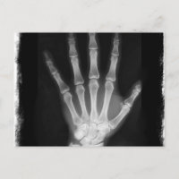 Mano de esqueleto de rayos X de B&W