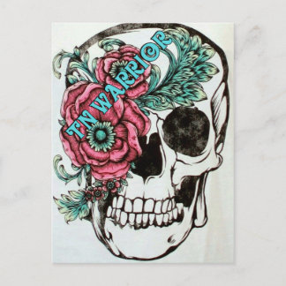 Postal Neuralgia trigeminal Conciencia