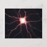 Neuronas hipocampales 2