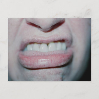 Postal No sonreír hoy