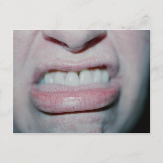 Postal No sonreír hoy (Anverso)