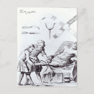 Postal Operación quirúrgica para amputar una pierna